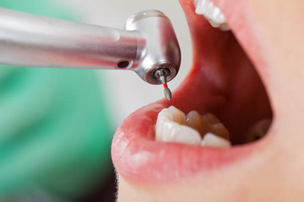 Best Emergency Dental Care for Broken or Chipped Teeth in Mayodan, NC